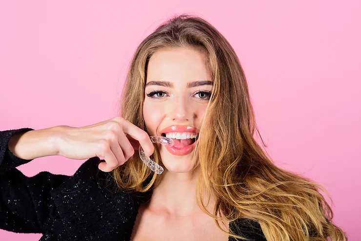 Everything you need to know about Invisalign in Mill Hill